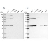 Anti-WRNIP1 antibody produced in rabbit Prestige Antibodies® Powered by Atlas Antibodies, affinity isolated antibody, buffered aqueous glycerol solution