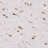 Anti-RAB22A antibody produced in rabbit Prestige Antibodies® Powered by Atlas Antibodies, affinity isolated antibody, buffered aqueous glycerol solution
