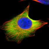 Anti-UBE2D2 antibody produced in rabbit Prestige Antibodies® Powered by Atlas Antibodies, affinity isolated antibody, buffered aqueous glycerol solution
