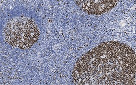 Anti-Ki67 Antibody, clone 1O15, ZooMAb® Rabbit Monoclonal recombinant, expressed in HEK 293 cells