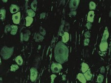 Anti-Internexin α Antibody serum, Chemicon®