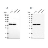 Anti-MRPS9 antibody produced in rabbit Prestige Antibodies® Powered by Atlas Antibodies, affinity isolated antibody, buffered aqueous glycerol solution