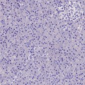 Anti-MIIP antibody produced in rabbit Prestige Antibodies® Powered by Atlas Antibodies, affinity isolated antibody, buffered aqueous glycerol solution