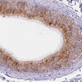Anti-NXPE2 antibody produced in rabbit Prestige Antibodies® Powered by Atlas Antibodies, affinity isolated antibody, buffered aqueous glycerol solution