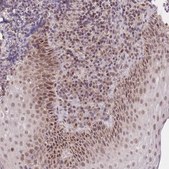 Anti-PUS10 antibody produced in rabbit Prestige Antibodies® Powered by Atlas Antibodies, affinity isolated antibody, buffered aqueous glycerol solution