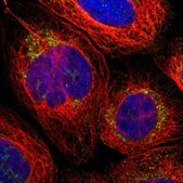 Anti-PARL antibody produced in rabbit Prestige Antibodies® Powered by Atlas Antibodies, affinity isolated antibody, buffered aqueous glycerol solution