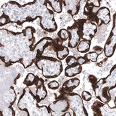 Monoclonal Anti-BCL2 antibody produced in mouse Prestige Antibodies® Powered by Atlas Antibodies, clone CL7935, purified immunoglobulin, buffered aqueous glycerol solution