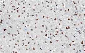 Anti-Bcl3 Antibody, clone 1E9 ZooMAb® Rabbit Monoclonal recombinant, expressed in HEK 293 cells