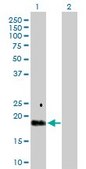 Anti-TGFA antibody produced in rabbit purified immunoglobulin, buffered aqueous solution