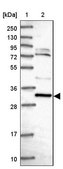 Anti-CCDC106 antibody produced in rabbit Prestige Antibodies® Powered by Atlas Antibodies, affinity isolated antibody, buffered aqueous glycerol solution