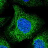 Anti-UBXN4 antibody produced in rabbit Prestige Antibodies® Powered by Atlas Antibodies, affinity isolated antibody, buffered aqueous glycerol solution