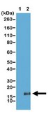 Anti-trimethyl Histone H3 (Lys36) Antibody, clone RM155 clone RM155, from rabbit