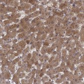 Anti-SULT2A1 antibody produced in rabbit Prestige Antibodies® Powered by Atlas Antibodies, affinity isolated antibody, buffered aqueous glycerol solution