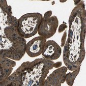 Anti-KANK1 antibody produced in rabbit Prestige Antibodies® Powered by Atlas Antibodies, affinity isolated antibody, buffered aqueous glycerol solution