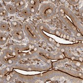 Anti-USH1C antibody produced in rabbit Prestige Antibodies® Powered by Atlas Antibodies, affinity isolated antibody, buffered aqueous glycerol solution, ab1