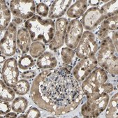 Anti-FAM172A antibody produced in rabbit Prestige Antibodies® Powered by Atlas Antibodies, affinity isolated antibody, buffered aqueous glycerol solution