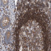 Anti-PRKD2 antibody produced in rabbit Prestige Antibodies® Powered by Atlas Antibodies, affinity isolated antibody, buffered aqueous glycerol solution