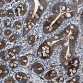 Anti-URGCP antibody produced in rabbit Prestige Antibodies® Powered by Atlas Antibodies, affinity isolated antibody, buffered aqueous glycerol solution, Ab1