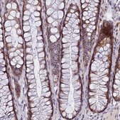 Anti-TCOF1 antibody produced in rabbit Prestige Antibodies® Powered by Atlas Antibodies, affinity isolated antibody, buffered aqueous glycerol solution