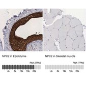 Anti-NPC2 antibody produced in rabbit Prestige Antibodies® Powered by Atlas Antibodies, affinity isolated antibody, buffered aqueous glycerol solution