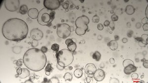 3dGRO® Human Liver Organoids (ID CS235475) Normal, Liver, Age: 63, Female, Mutation: None