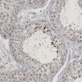 Anti-ZNF674 antibody produced in rabbit Prestige Antibodies® Powered by Atlas Antibodies, affinity isolated antibody, buffered aqueous glycerol solution