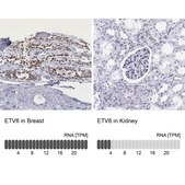 Anti-ETV6 antibody produced in rabbit Prestige Antibodies® Powered by Atlas Antibodies, affinity isolated antibody, buffered aqueous glycerol solution