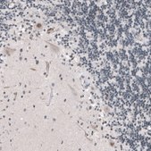 Anti-KMT5C antibody produced in rabbit Prestige Antibodies® Powered by Atlas Antibodies, affinity isolated antibody, buffered aqueous glycerol solution