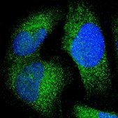 Anti-JMJD7 antibody produced in rabbit Prestige Antibodies® Powered by Atlas Antibodies, affinity isolated antibody, buffered aqueous glycerol solution