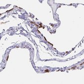 Anti-SLC34A2 antibody produced in rabbit Prestige Antibodies® Powered by Atlas Antibodies, affinity isolated antibody, buffered aqueous glycerol solution
