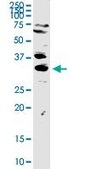 Anti-TREX1 antibody produced in rabbit purified immunoglobulin, buffered aqueous solution