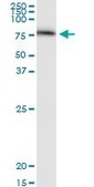 Monoclonal Anti-SERPING1 antibody produced in mouse clone 3F4-1D9, purified immunoglobulin, buffered aqueous solution