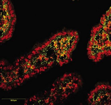 Anti-MMP-2 Proform Antibody, NT, clone CA-4001 clone CA-4001, Chemicon&#174;, from mouse