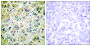 Anti-Vimentin antibody produced in rabbit affinity isolated antibody