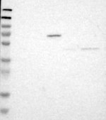 Anti-B3GNT7 antibody produced in rabbit Prestige Antibodies® Powered by Atlas Antibodies, affinity isolated antibody, buffered aqueous glycerol solution