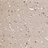 Anti-CLOCK antibody produced in rabbit Prestige Antibodies® Powered by Atlas Antibodies, affinity isolated antibody, buffered aqueous glycerol solution