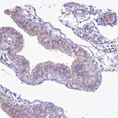 Anti-BANK1 antibody produced in rabbit Prestige Antibodies® Powered by Atlas Antibodies, affinity isolated antibody, buffered aqueous glycerol solution