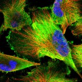 Anti-PDAP1 antibody produced in rabbit Prestige Antibodies® Powered by Atlas Antibodies, affinity isolated antibody, buffered aqueous glycerol solution