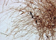 Anti-Tyrosine Hydroxylase Antibody, clone 2/40/15 clone 2/40/15, Chemicon®, from mouse