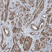 Anti-SH3BGRL3 antibody produced in rabbit Prestige Antibodies® Powered by Atlas Antibodies, affinity isolated antibody, buffered aqueous glycerol solution