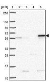 Anti-SARS2 antibody produced in rabbit Prestige Antibodies® Powered by Atlas Antibodies, affinity isolated antibody, buffered aqueous glycerol solution