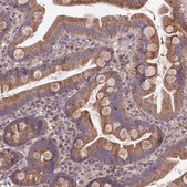 Anti-SDHD antibody produced in rabbit Prestige Antibodies® Powered by Atlas Antibodies, affinity isolated antibody, buffered aqueous glycerol solution