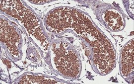 Anti-PRMT9 Antibody, clone 128-29-1 clone 128-29-1, from mouse