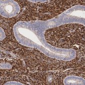 Anti-LGALS1 antibody produced in rabbit Prestige Antibodies® Powered by Atlas Antibodies, affinity isolated antibody, buffered aqueous glycerol solution