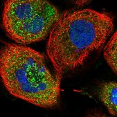Anti-ZFYVE16 antibody produced in rabbit Prestige Antibodies® Powered by Atlas Antibodies, affinity isolated antibody, buffered aqueous glycerol solution