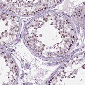 Anti-TBPL1 antibody produced in rabbit Prestige Antibodies® Powered by Atlas Antibodies, affinity isolated antibody, buffered aqueous glycerol solution