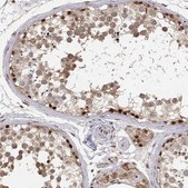 Anti-BRCA1 Prestige Antibodies® Powered by Atlas Antibodies, affinity isolated antibody