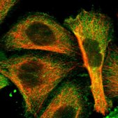 Anti-ATG7 antibody produced in rabbit Prestige Antibodies® Powered by Atlas Antibodies, affinity isolated antibody, buffered aqueous glycerol solution