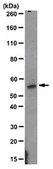 Anticuerpo anti-ROR gamma T, clon 6F3.1 clone 6F3.1, from mouse