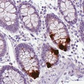 Monoclonal Anti-CHGA antibody produced in mouse Prestige Antibodies® Powered by Atlas Antibodies, clone CL0166, purified immunoglobulin, buffered aqueous glycerol solution